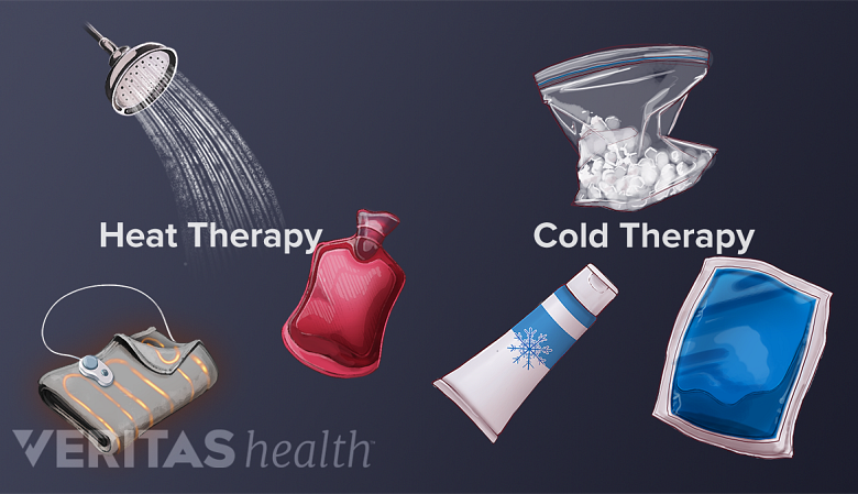Various types of heat and cold therapies including hot water bottle, hot shower, heating pad, bag of ice, ice pack, cooling cream